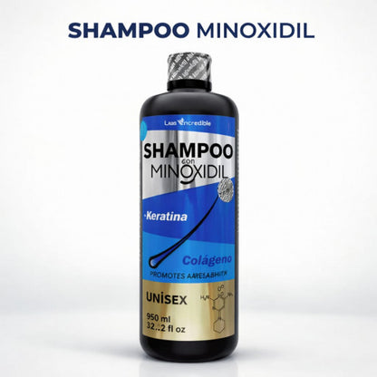 Shampoo Minoxidil Green Royalty – Crecimiento y Fuerza en Cada Gota