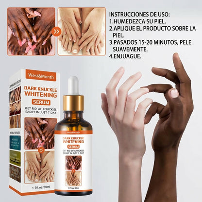 Recupera la confianza en tus manos con un sérum natural que aclara, hidrata y suaviza los nudillos en solo 7 días.”