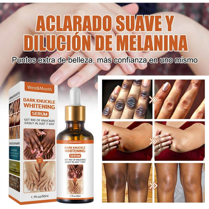 Recupera la confianza en tus manos con un sérum natural que aclara, hidrata y suaviza los nudillos en solo 7 días.”