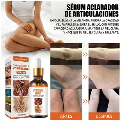 Recupera la confianza en tus manos con un sérum natural que aclara, hidrata y suaviza los nudillos en solo 7 días.”