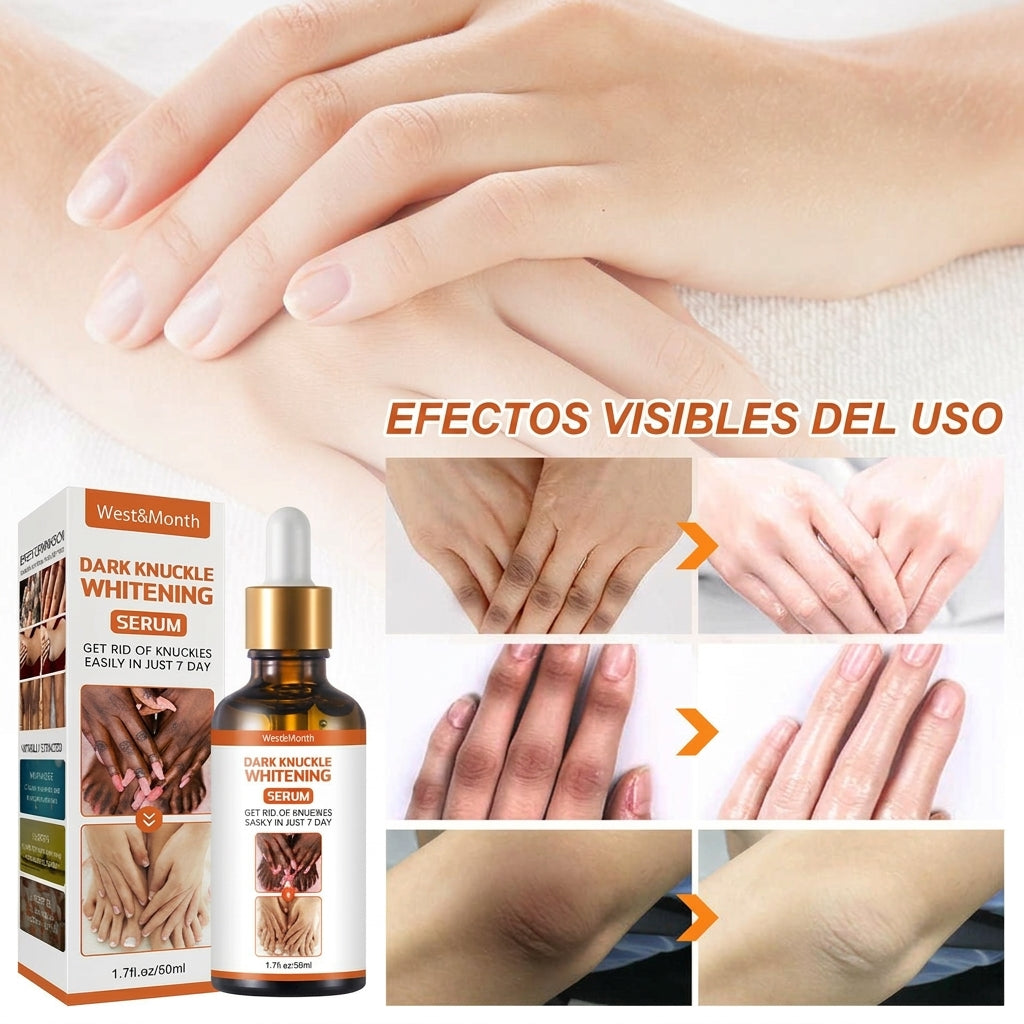 Recupera la confianza en tus manos con un sérum natural que aclara, hidrata y suaviza los nudillos en solo 7 días.”