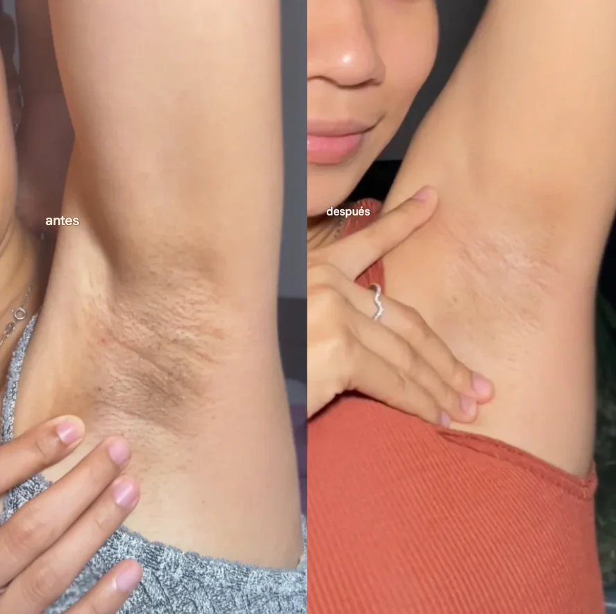 Dr. Melaxin Peel Shot + Regalo Sorpresa | Exfoliante  con Ácido Kójico, Cúrcuma y Niacinamida | Piel  Luminosa Sin Manchas | Envío Guatemala 🇬🇹