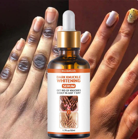 Recupera la confianza en tus manos con un sérum natural que aclara, hidrata y suaviza los nudillos en solo 7 días.”