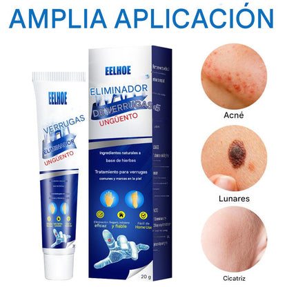 CREMA REMOVEDORA DE VERRUGAS, Piel limpia, segura y libre de preocupaciones.