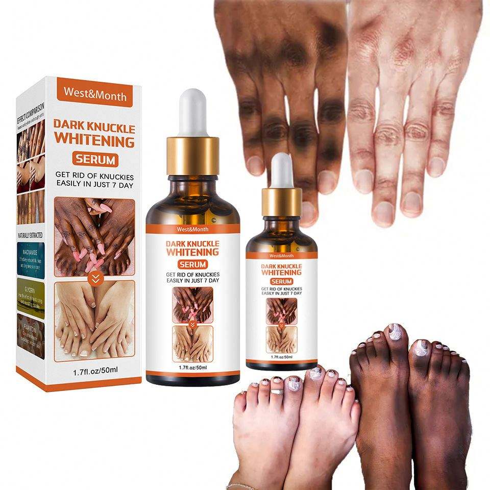 Recupera la confianza en tus manos con un sérum natural que aclara, hidrata y suaviza los nudillos en solo 7 días.”
