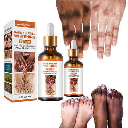 Recupera la confianza en tus manos con un sérum natural que aclara, hidrata y suaviza los nudillos en solo 7 días.”