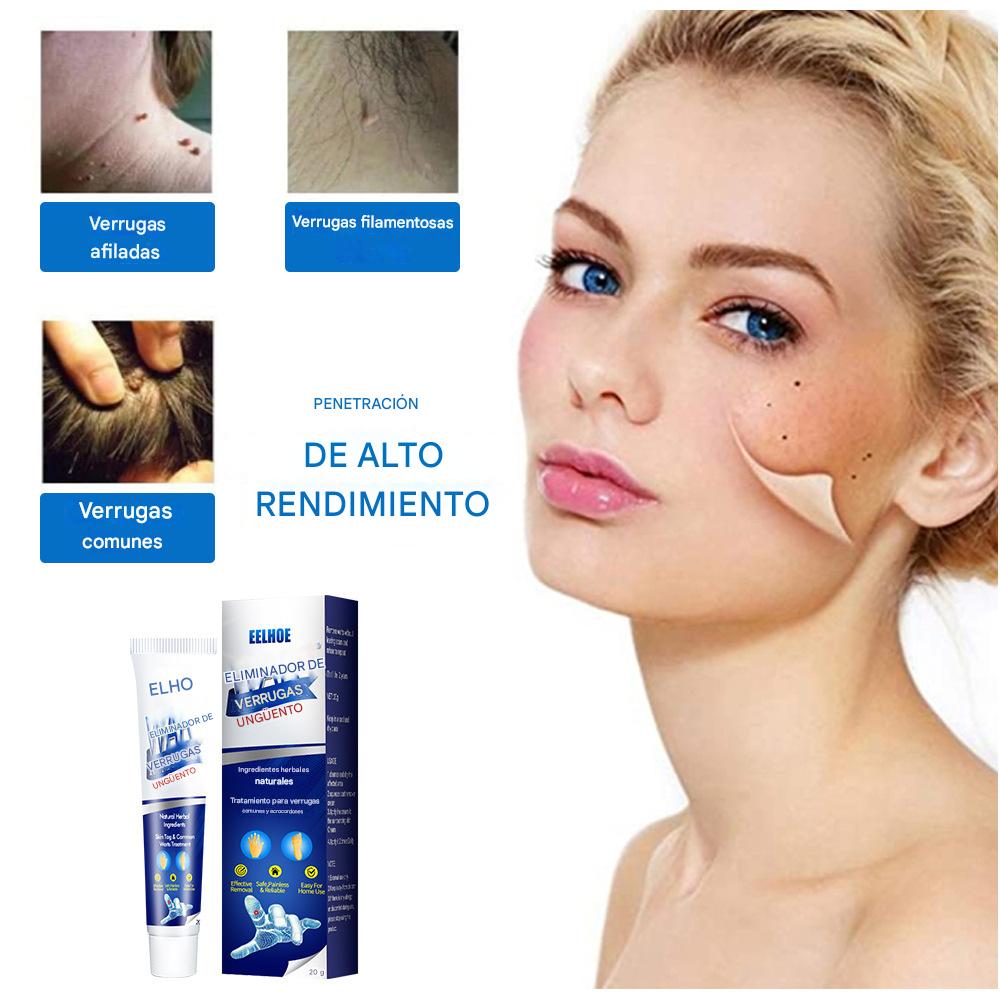 CREMA REMOVEDORA DE VERRUGAS, Piel limpia, segura y libre de preocupaciones.