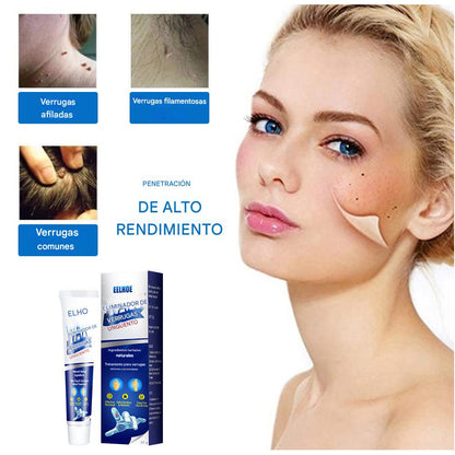 CREMA REMOVEDORA DE VERRUGAS, Piel limpia, segura y libre de preocupaciones.