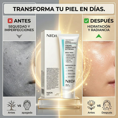 NIDA Cream: Hidratación Total y Luminosidad