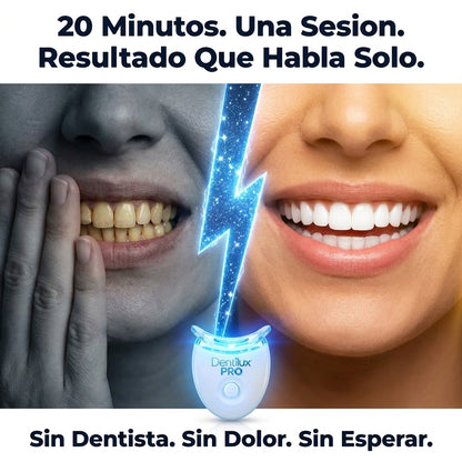 Dentilux PRO — Blanquea Tus Dientes 5 Tonos Más en Solo 20 Minutos Desde Casa ✨