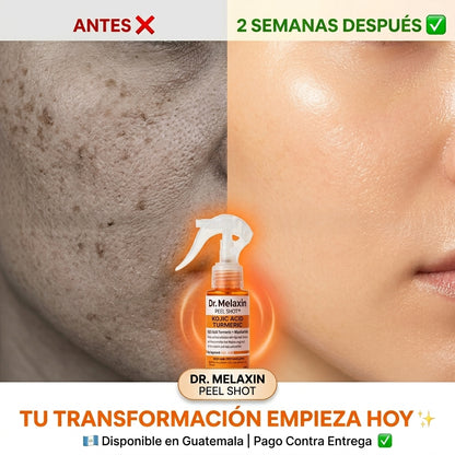Dr. Melaxin Peel Shot + Regalo Sorpresa | Exfoliante  con Ácido Kójico, Cúrcuma y Niacinamida | Piel  Luminosa Sin Manchas | Envío Guatemala 🇬🇹