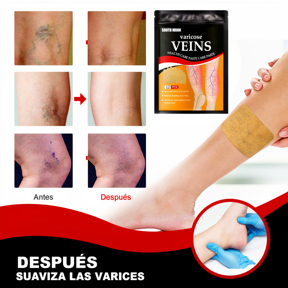 Alivio Natural para Venas y Piernas