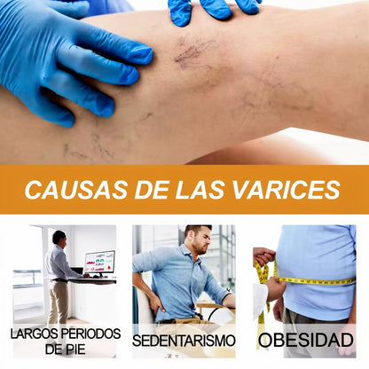 Alivio Natural para Venas y Piernas