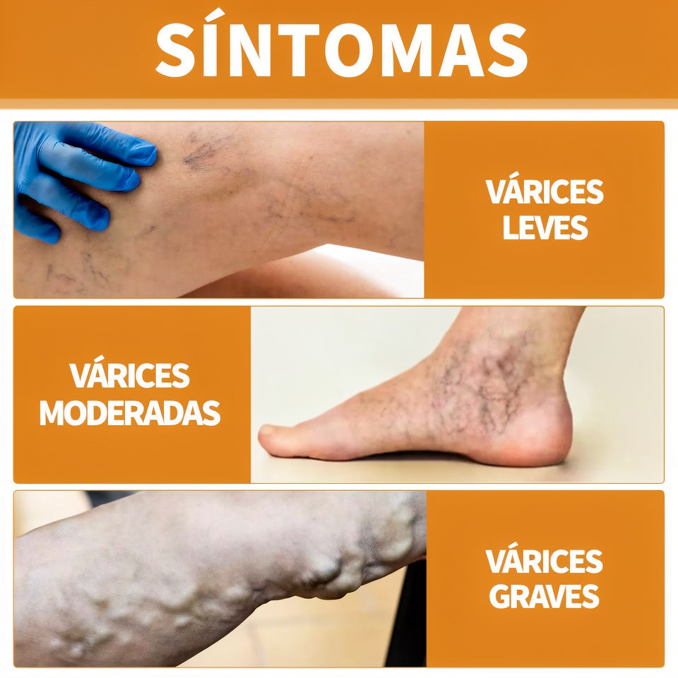 Alivio Natural para Venas y Piernas