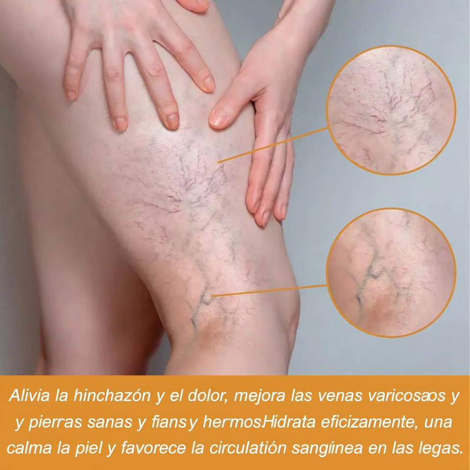 Alivio Natural para Venas y Piernas