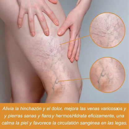 Alivio Natural para Venas y Piernas