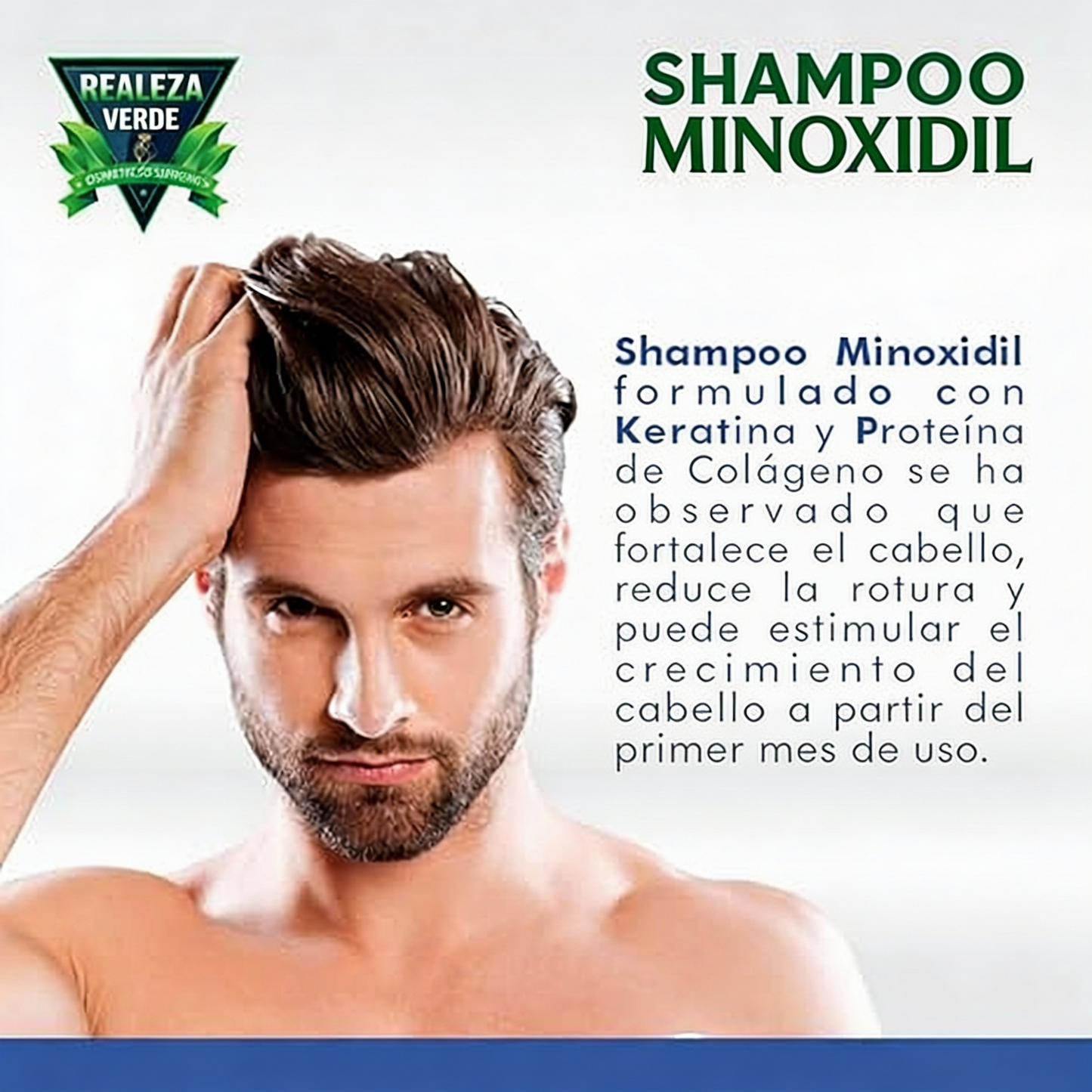 Shampoo Minoxidil Green Royalty – Crecimiento y Fuerza en Cada Gota