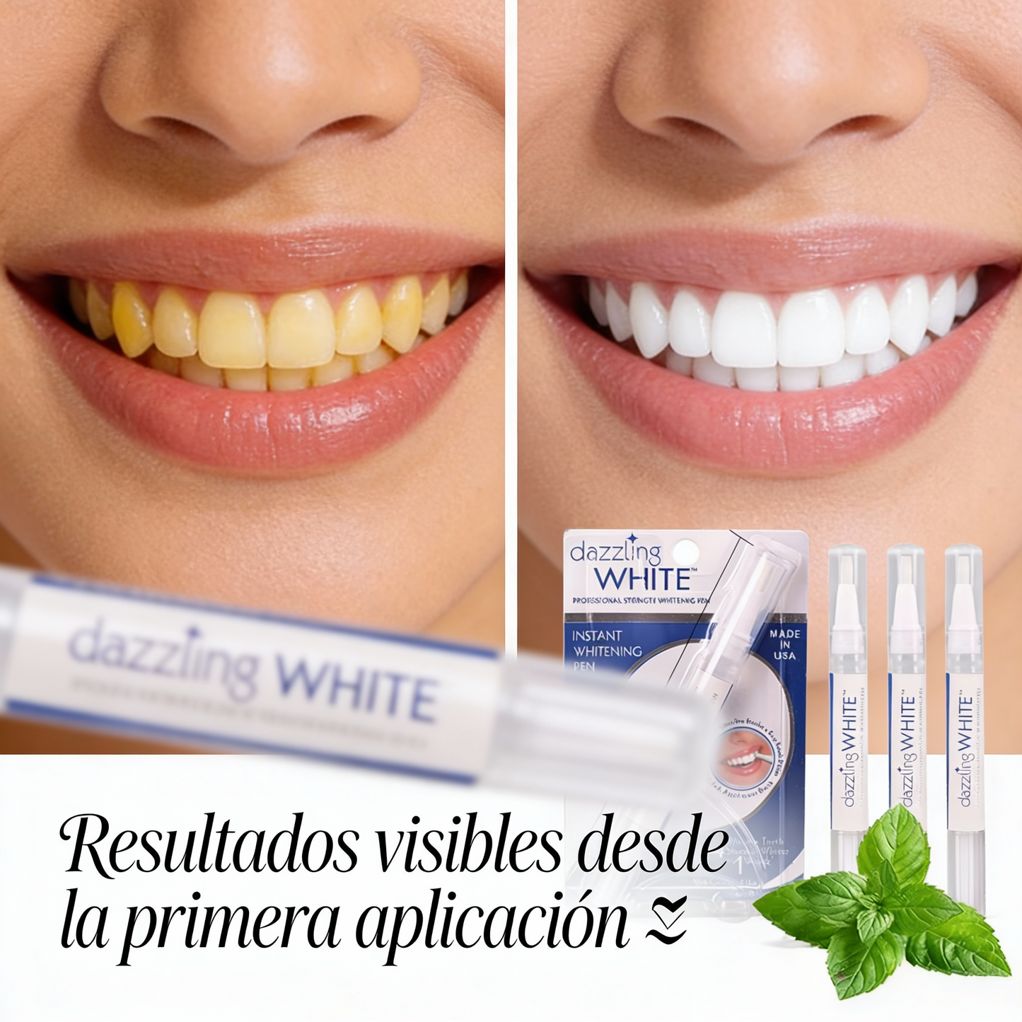Dazzling WHITE™ – Tu Sonrisa Más Brillante en 1 Semana