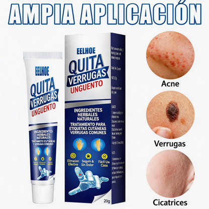 CREMA REMOVEDORA DE VERRUGAS, Piel limpia, segura y libre de preocupaciones.
