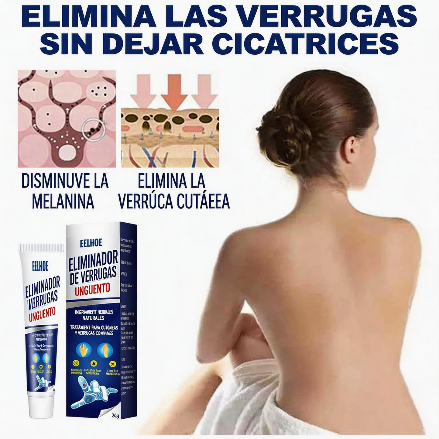 CREMA REMOVEDORA DE VERRUGAS, Piel limpia, segura y libre de preocupaciones.