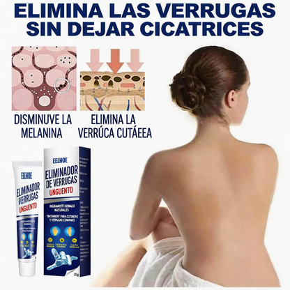 CREMA REMOVEDORA DE VERRUGAS, Piel limpia, segura y libre de preocupaciones.
